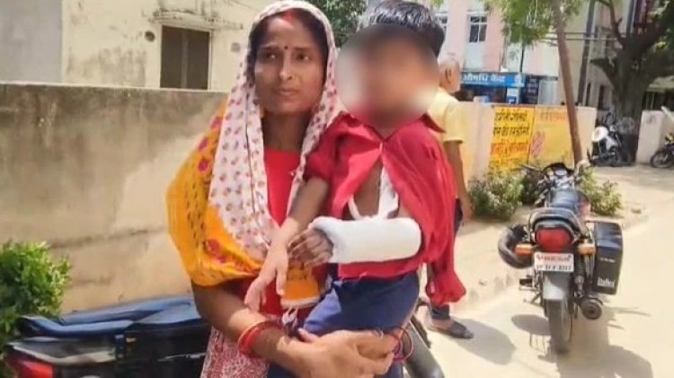 फ्रैक्चर दाहिने हाथ में, प्लास्टर बाएं पर