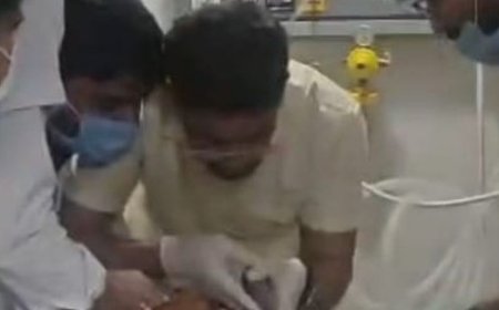 सांस की नली में फंसा प्लास्टिक, CPR से बची जान:लखनऊ में डॉक्टरों ने सक्शन मशीन से निकाला, फेफड़ों से दाल का पानी भी साफ किया