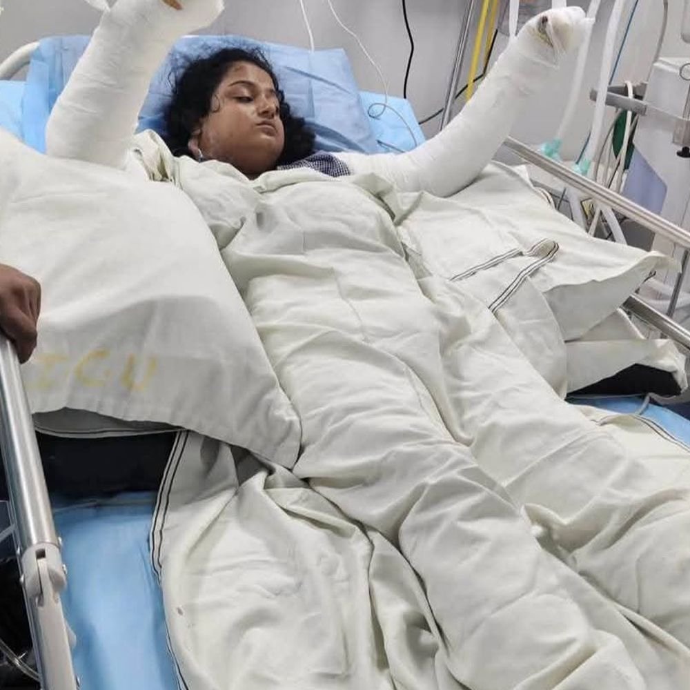 किसान और दो बेटियां करंट लगने से झुलसे:इलाज में आएगा 50 लाख का खर्च, मदद के लिए आगे आई देवदूत वानर सेना