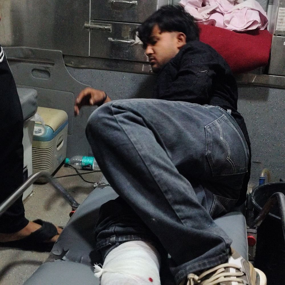 आगरा में रंजिश में युवक को मारी गोली:प्रेम विवाह के बाद ससुराल वालों से चल रहा था विवाद; अस्पताल में भर्ती