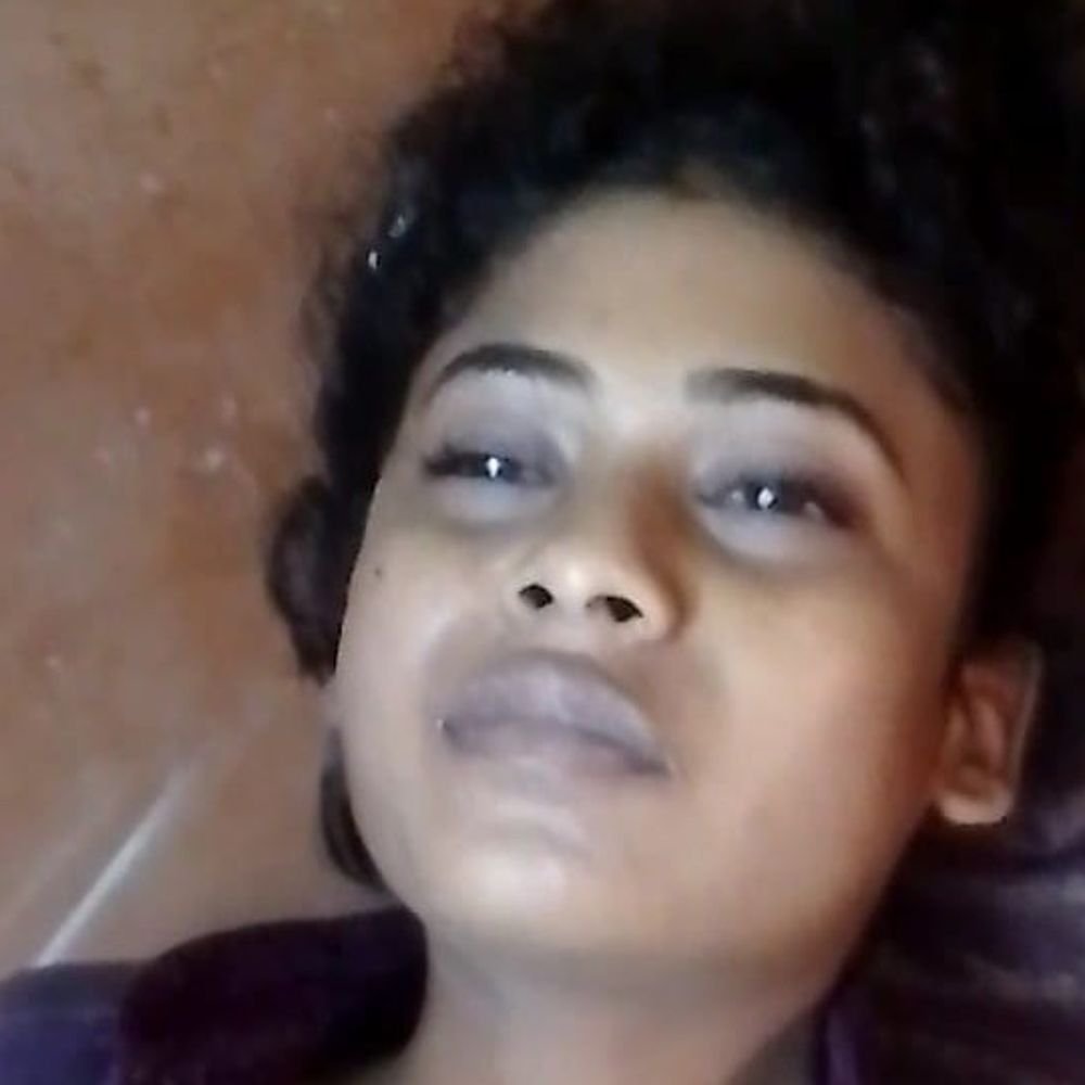 रायबरेली में सांप के डंसने से युवती की मौत:हालत बिगड़ने पर नसीराबाद अस्पताल लेकर पहुंचे परिजन, डॉक्टरों ने मृत घोषित किया