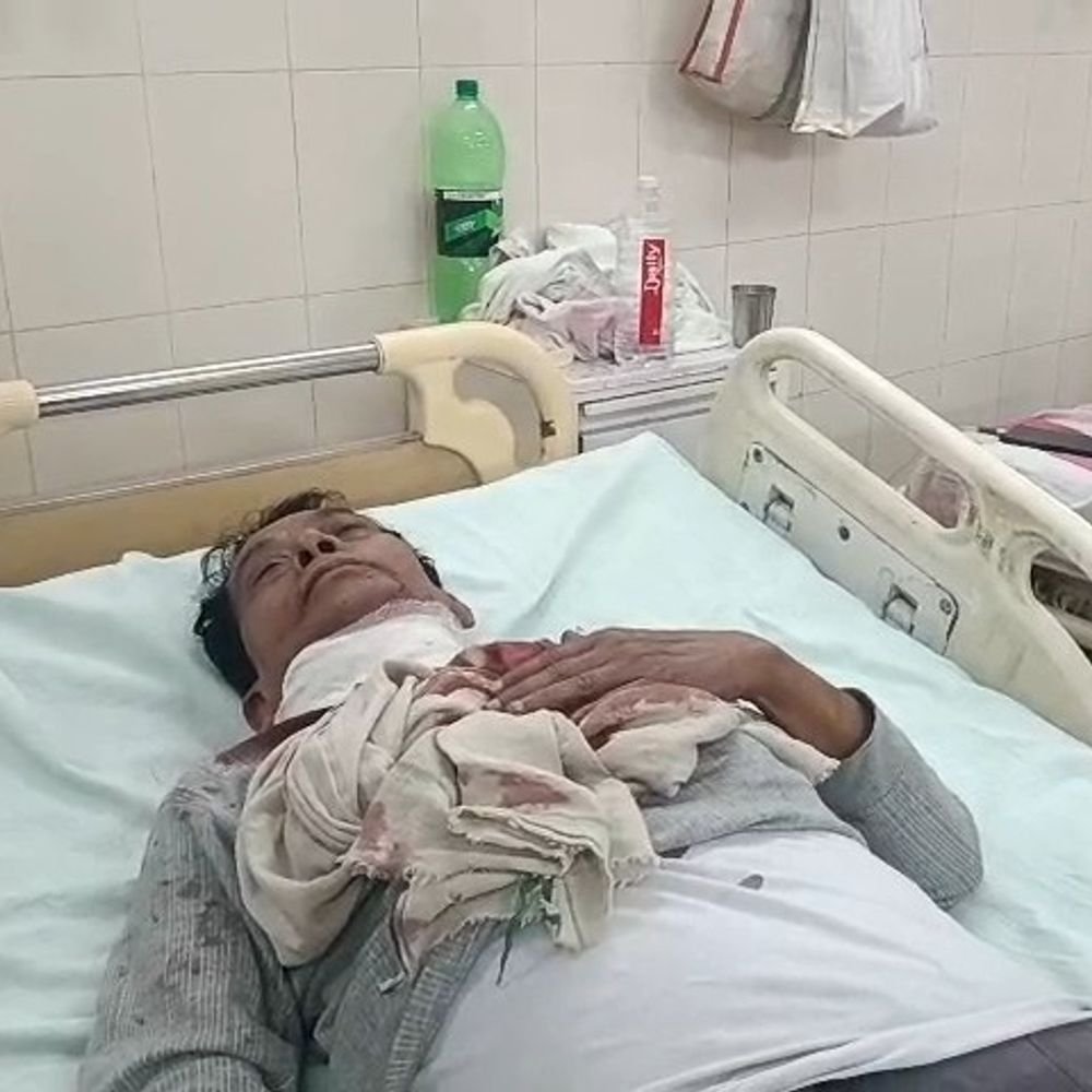उन्नाव में डीजल विक्रेता पर चाकू से हमला:50 हजार लूटे, घर के सामने रहने वाले युवक पर आरोप, घायल अस्पताल में भर्ती