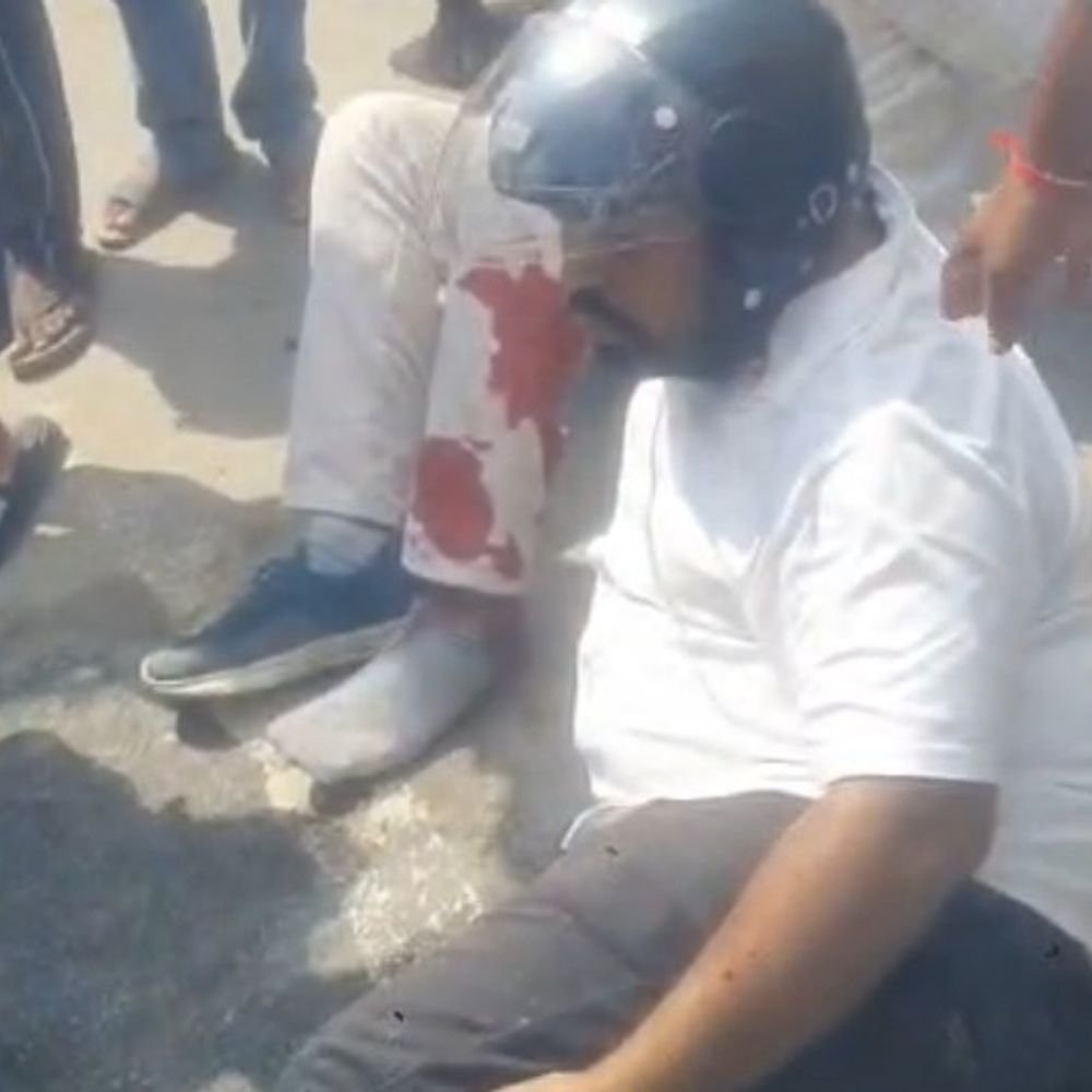 गबडुआ नहर पुल पर दो बाइकों की टक्कर:ओमप्रकाश महाविद्यालय के प्रिंसिपल समेत दो लोग गंभीर घायल