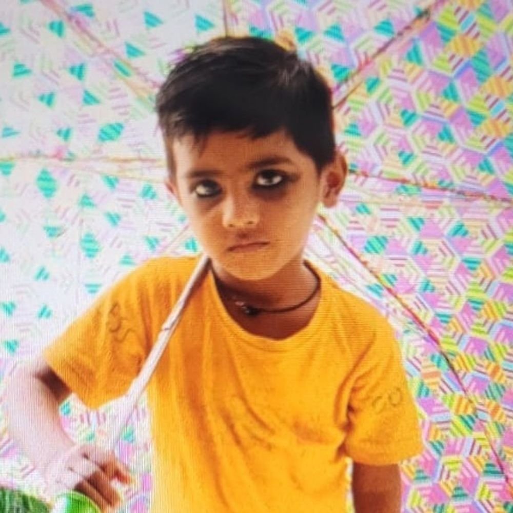 बारिश में कच्ची दीवार गिरी, बच्चे की मौत:चचेरा भाई गंभीर, मलबे में दबे थे दोनों बच्चे, लखनऊ ट्रामा सेंटर रेफर