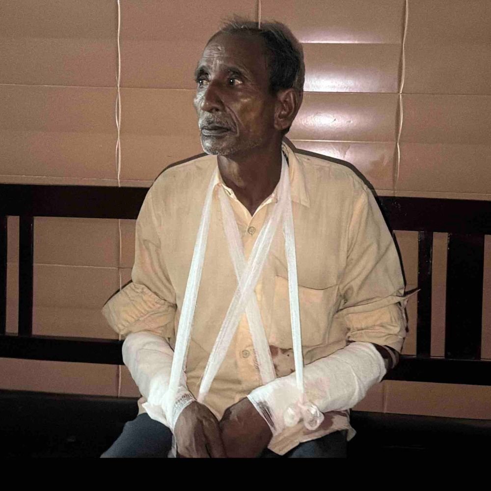 बच्चों के विवाद में बुजुर्ग से मारपीट, दोनों हाथ टूटे:मथुरापुर कला में लाठी-डंडों से पीटा, पुलिस मेडिकल रिपोर्ट पर कार्रवाई होगी