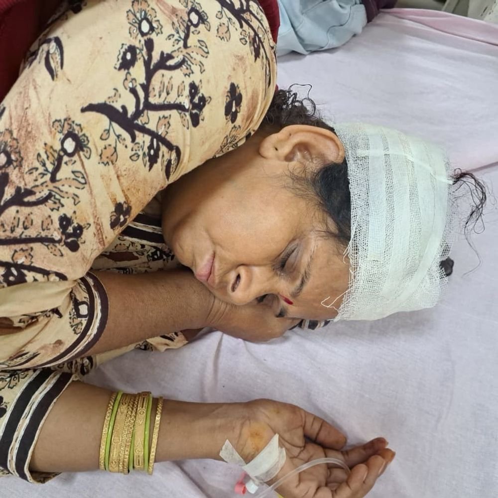 नाली विवाद में दंपती का सिर फोड़ा:गंभीर हालत में ट्रॉमा सेंटर में भर्ती, लाठी-डंडों से किया हमला