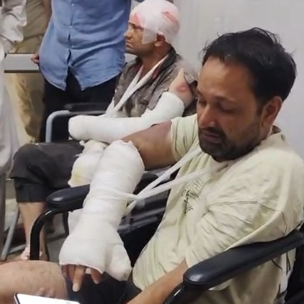 बागपत में बाइक सवार दो भाइयों पर लाठी-डंडों से हमला:दोनों गंभीर घायल, एक के हाथ-पैर की हड्डी टूटी; पुरानी रंजिश में केस दर्ज, तलाश जारी