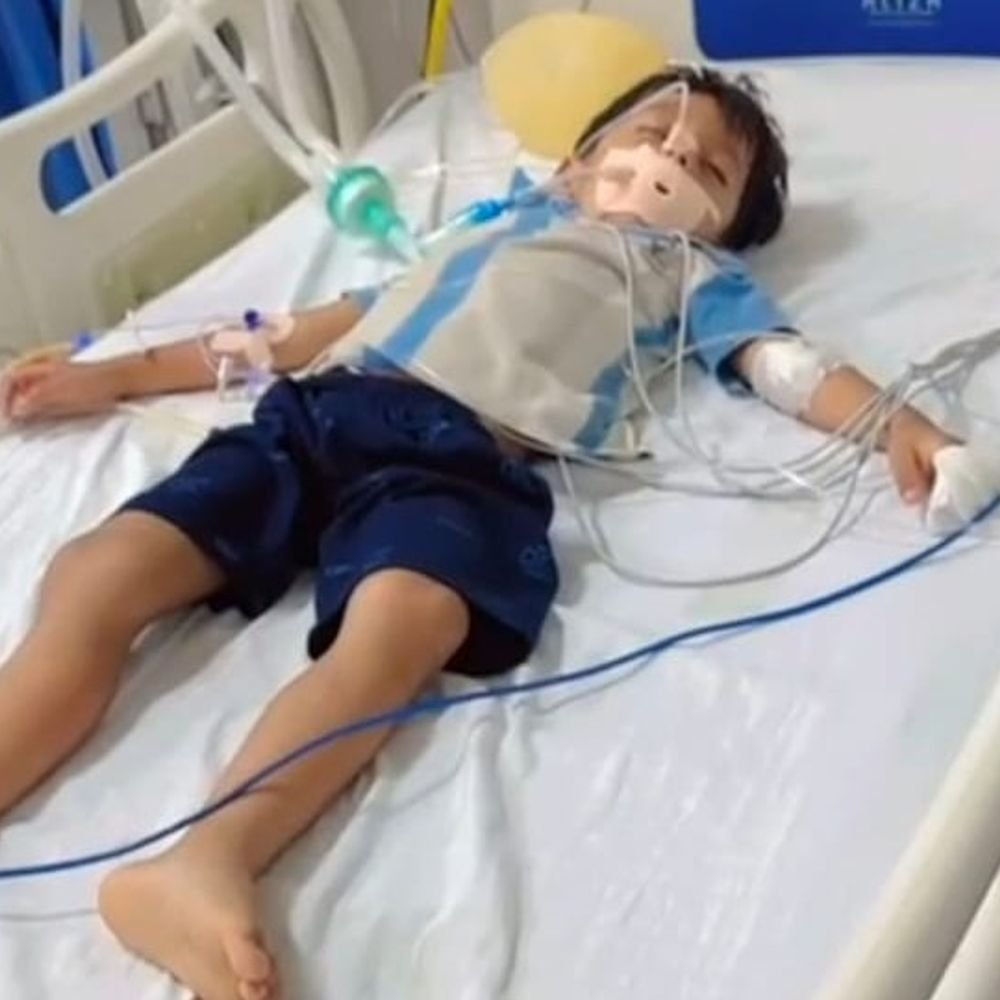 बच्चे को एंटी वेनम की जगह रेबीज इंजेक्शन लगाया:मासूम आईसीयू में भर्ती; जांच के लिए 3 डॉक्टरों की टीम बनी