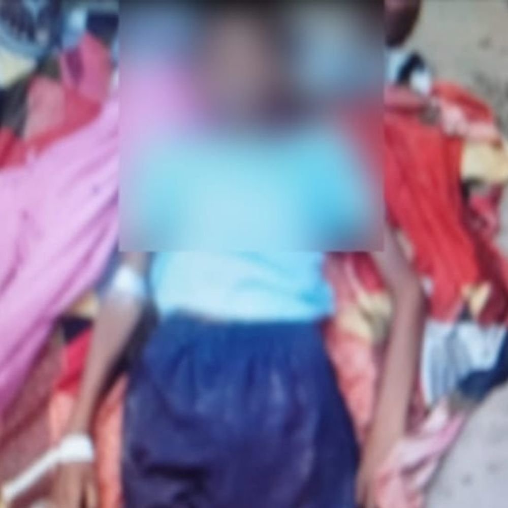 कबड्डी खेलते समय किशोर की मौत, मारपीट का आरोप:आगरा में इलाज के दौरान देर रात तोड़ा दम, शव पोस्टमार्टम को भेजा गया