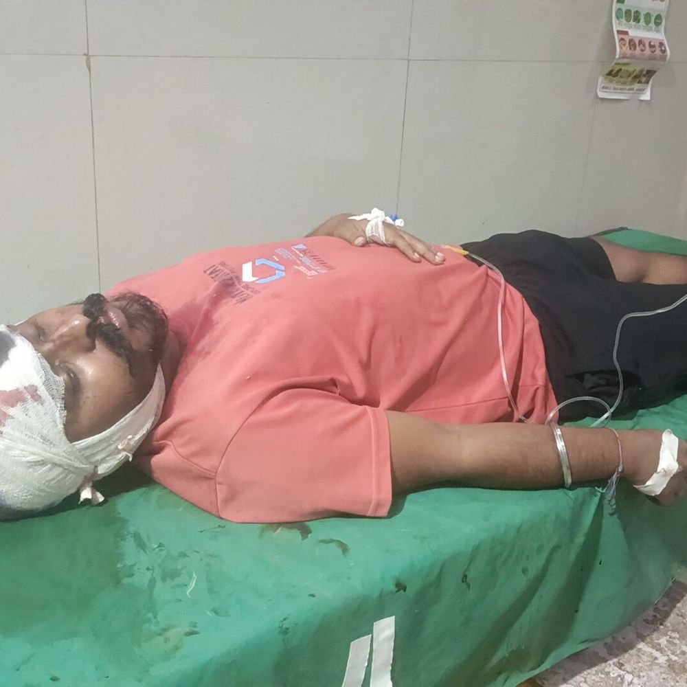 रायबरेली में सर्राफा व्यापारी को पीटकर जेवर लूटे:दुकान बंद कर घर लौटते समय वारदात, स्विफ्ट कार से पहुंचे 4 बदमाश