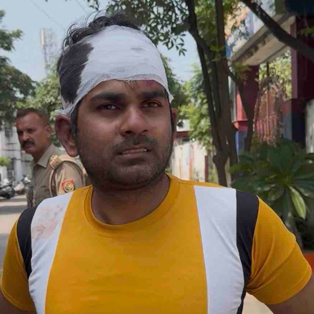 कानपुर के लालबंगला में थेरेपिस्ट पर दिनदहाड़े हमला:पांच बदमाशों ने बेल्टों से पीटा, बैग और मोबाइल भी लूटे