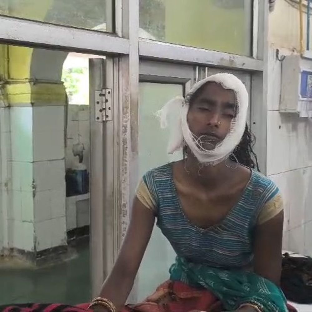सीतापुर में बाइक सवार तीन लोगों पर गिरा पेड़:महिला और मासूम बच्ची समेत तीन घायल, ग्रामीणों ने टहनियां हटाकर बाहर निकाला