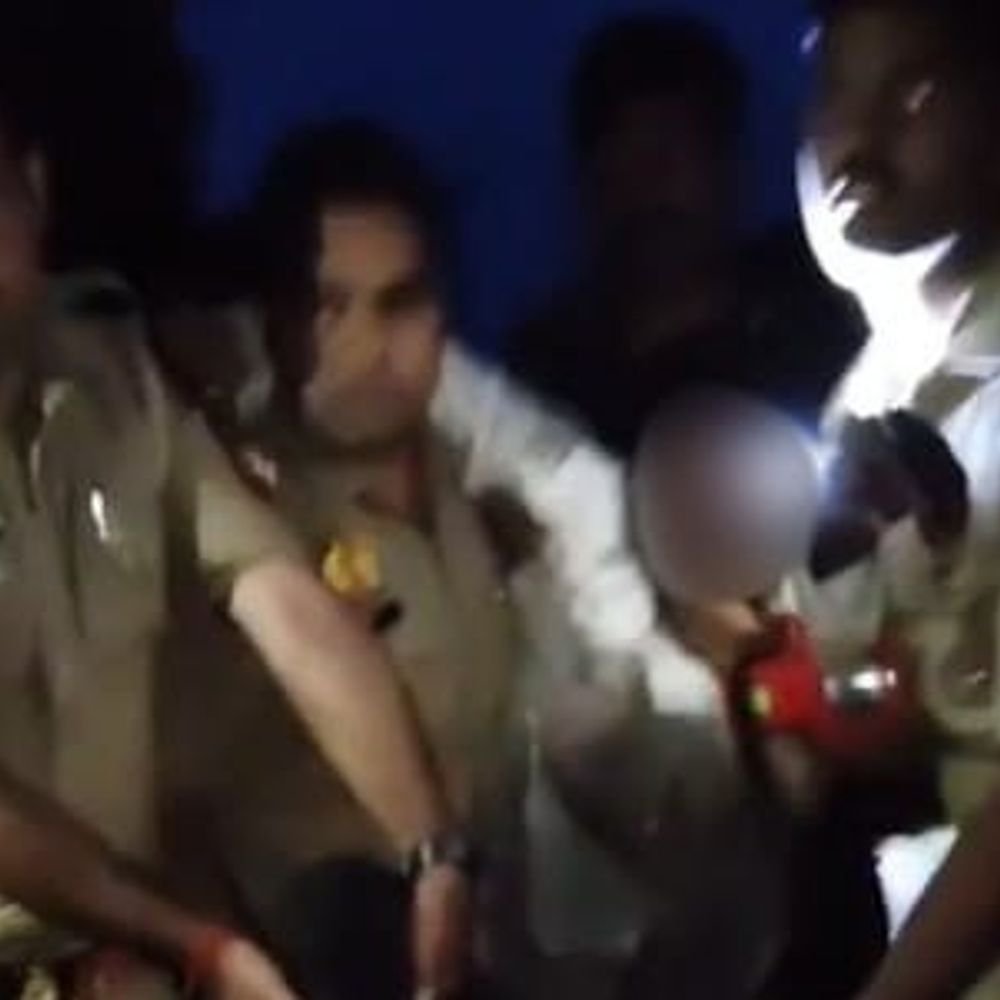 फतेहपुर में पुलिस मुठभेड़, गोवध मामले का वांछित अभियुक्त घायल:पैर में गोली लगने से घायल हुआ अब्बास, तमंचा-कारतूस बरामद