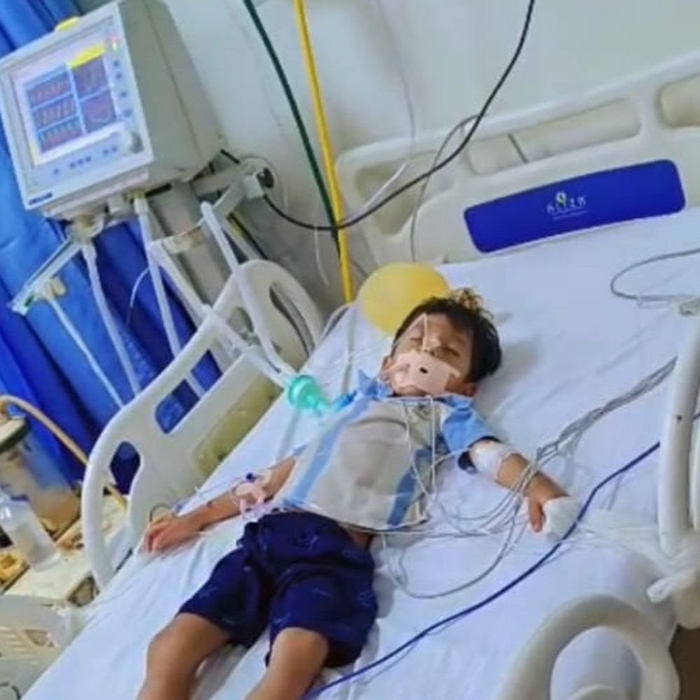 संभल में एंटी-वैमन की जगह एंटी-रेबीज लगाने में फार्मासिस्ट दोषी:CMO-सिटी मजिस्ट्रेट ने जांच रिपोर्ट DM को सौंपी, वेंटिलेटर पर बच्चे का इलाज