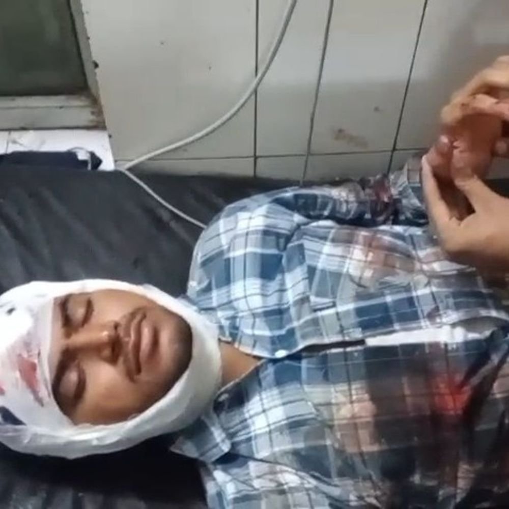 गोंडा में मीडियाकर्मी पर जानलेवा हमला:दीवानी कचहरी गेट के पास चाय पीते समय दबंगों ने सिर फोड़ा, मेडिकल कॉलेज में भर्ती