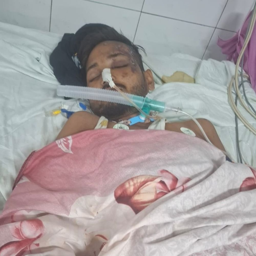 तिलकपुर के युवक को अज्ञात वाहन ने रौंदा, लखनऊ में:गोटवा से लौट रहे थे घर, बस्ती से लखनऊ रेफर किया गया था