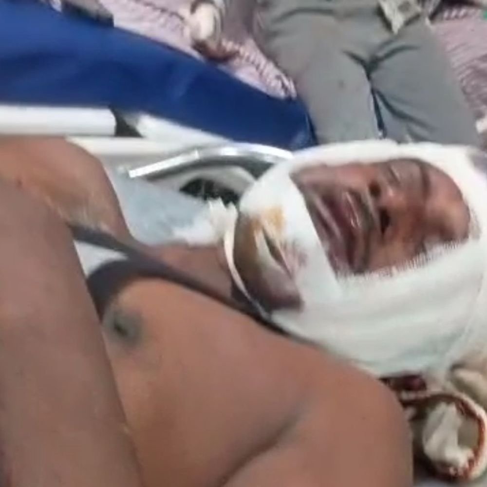 भूमि विवाद में तलवार से हमला, पिता-पुत्र समेत 4 घायल:दोनों पक्षों में हुई मारपीट; गंभीर घायल पिता को गोरखपुर रेफर किया