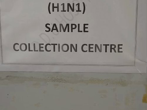 दीनदयाल अस्पताल में अब एच1एन1 की मुफ्त जांच:स्वाइन फ्लू पर स्वास्थ्य विभाग अलर्ट, अलीगढ़ में अब तक 73 संक्रमित मिले