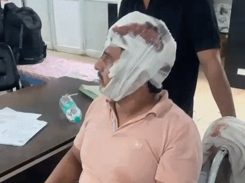 ओवरटेक पर विवाद, कार पर बरसाएं पत्थर:प्रॉपर्टी डीलर और साथी को लोहे के रॉड से पीटा, गंभीर रूप से घायल