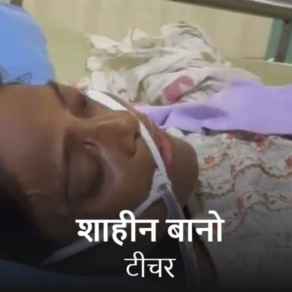 हरदोई की सरकारी टीचर शाहीन बानो की लखनऊ में मौत:BEO पर फोन पर डांटने का लगाया था आरोप, स्कूल में लगी थी आग