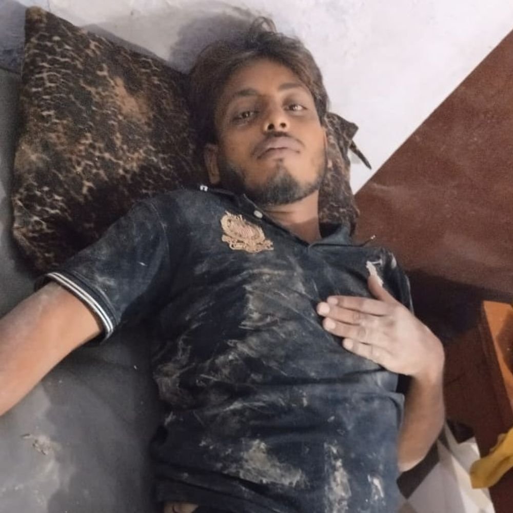 कौशांबी मेले में युवक को लगा करेंट:पूरब-पश्चिम शरीरा में बारिश के दौरान हुआ हादसा, गंभीर हालत में अस्पताल में भर्ती