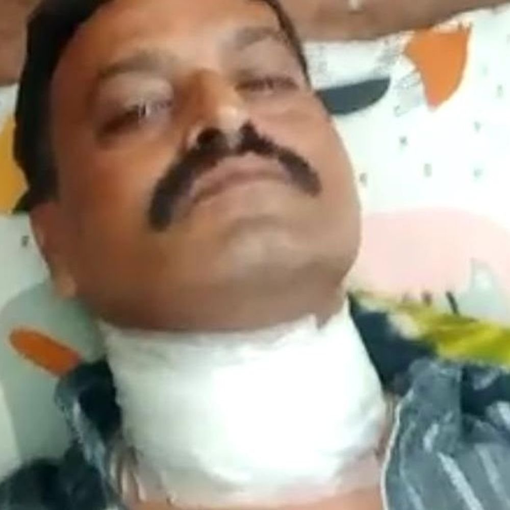 मांझे की चपेट में आए सचिवालय कर्मी की गर्दन कटी:गले में लगे तीन टांके, लालजी टंडन पुल के पास हुई घटना