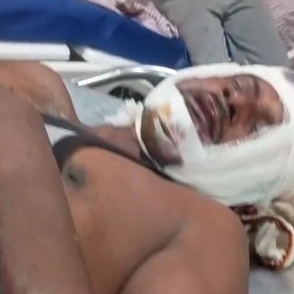 पुराने रास्ते के विवाद में तलवार से हमला:देवरिया में एक परिवार के 4 लोग घायल, पिता की हालत गंभीर, 7 नामजद पर केस