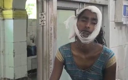 सीतापुर में बाइक सवार तीन लोगों पर गिरा पेड़:महिला और मासूम बच्ची समेत तीन घायल, ग्रामीणों ने टहनियां हटाकर बाहर निकाला