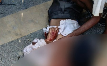 लखीमपुर में डीसीएम ने पैदल जा रहे युवक को रौंदा:सीएचसी में डॉक्टरों ने मृत घोषित किया, पोस्टमॉर्टम के लिए भेजा शव