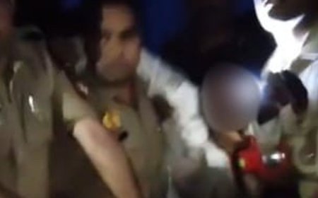 फतेहपुर में पुलिस मुठभेड़, गोवध मामले का वांछित अभियुक्त घायल:पैर में गोली लगने से घायल हुआ अब्बास, तमंचा-कारतूस बरामद
