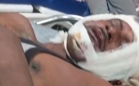 भूमि विवाद में तलवार से हमला, पिता-पुत्र समेत 4 घायल:दोनों पक्षों में हुई मारपीट; गंभीर घायल पिता को गोरखपुर रेफर किया