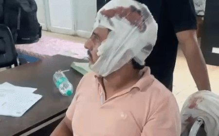 ओवरटेक पर विवाद, कार पर बरसाएं पत्थर:प्रॉपर्टी डीलर और साथी को लोहे के रॉड से पीटा, गंभीर रूप से घायल