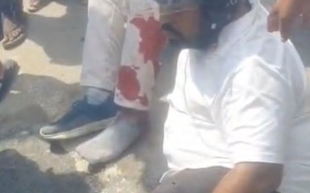 गबडुआ नहर पुल पर दो बाइकों की टक्कर:ओमप्रकाश महाविद्यालय के प्रिंसिपल समेत दो लोग गंभीर घायल