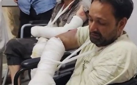 बागपत में बाइक सवार दो भाइयों पर लाठी-डंडों से हमला:दोनों गंभीर घायल, एक के हाथ-पैर की हड्डी टूटी; पुरानी रंजिश में केस दर्ज, तलाश जारी