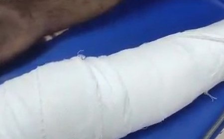 बाइक सवार दूध वाले को दबंगों ने पीटा:सिर और पैर में आई चोट, अस्पताल में भर्ती, आरोपी फरार