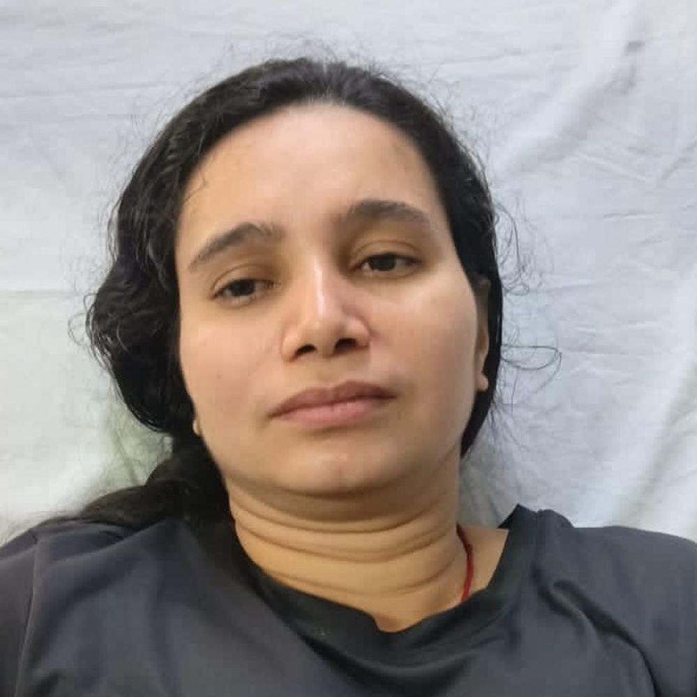 मेरठ PAC सेंटर पर फिजिकल टेस्ट में पांच अभ्यर्थी बेहोश:तीन महिला अभ्यर्थियों के पैर में फ्रैक्चर, SDS अस्पताल में भर्ती
