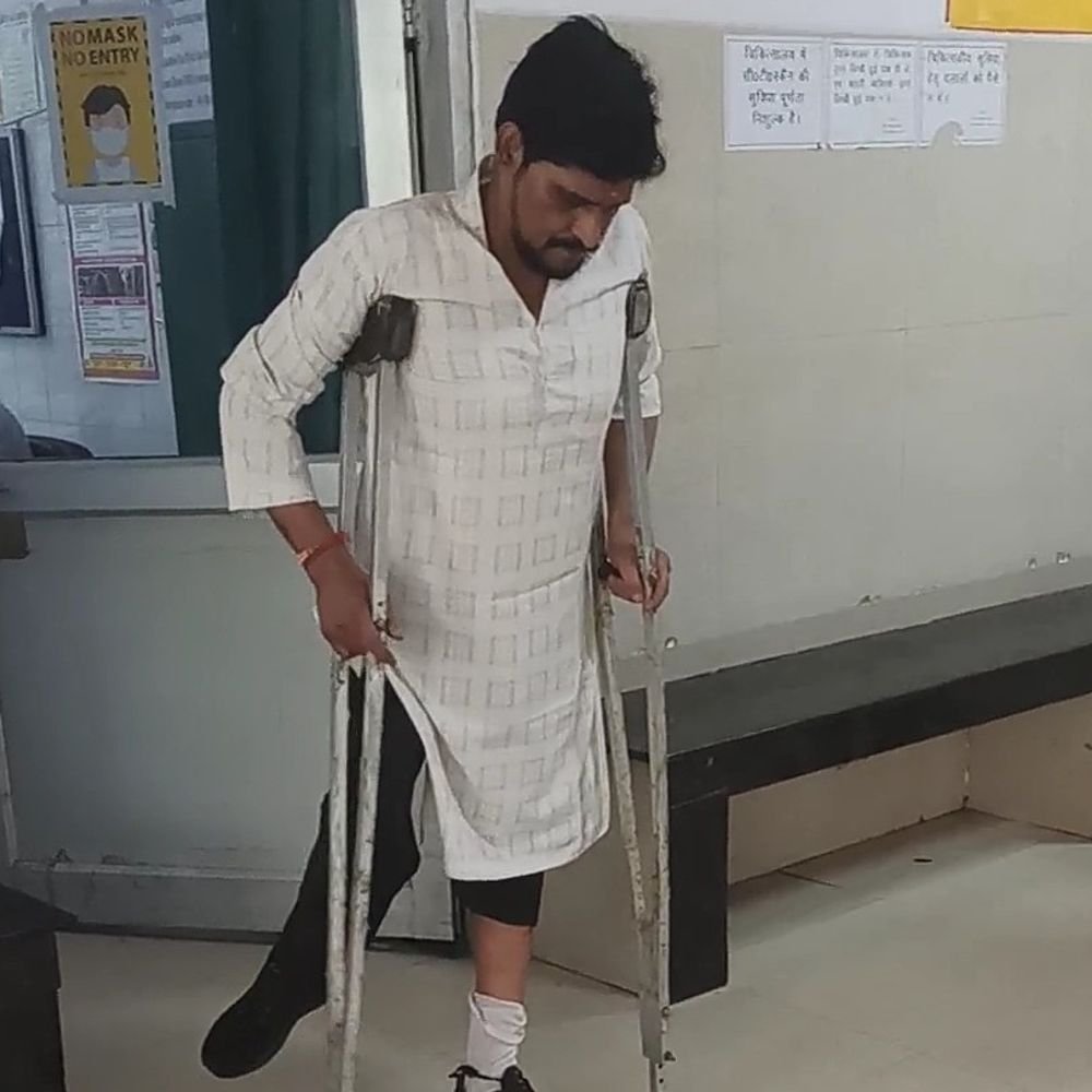 कानपुर में दिव्यांग प्रॉपर्टी डीलर पर कुत्तों का हमला:स्कूटी पर चढ़कर पैर में काटा, बैसाखी से भगाकर बचाई जान