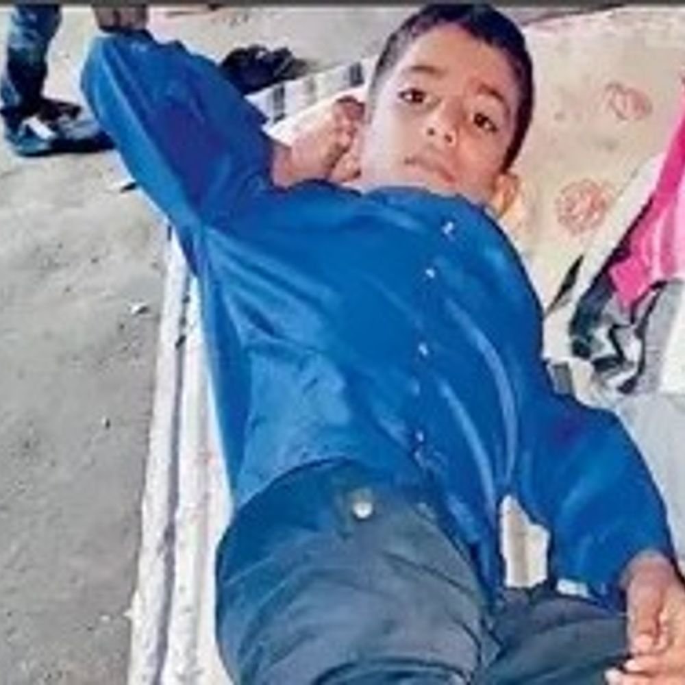 संतकबीर नगर में पागल सियार ने 30 लोगों को काटा:4 गांवों में हमला किया, अस्पताल में इंजेक्शन लगवाने को लगी भीड़