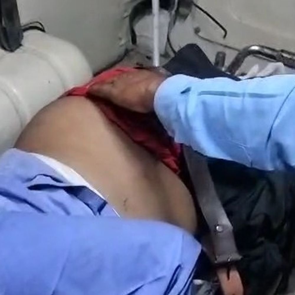 कुशीनगर में ट्रेन की चपेट में आकर दोनों पैर कटे:पुलिस बोली- शराब के नशे में रेलवे ट्रैक पर घूम रहा था लैब संचालक, हालत गंभीर
