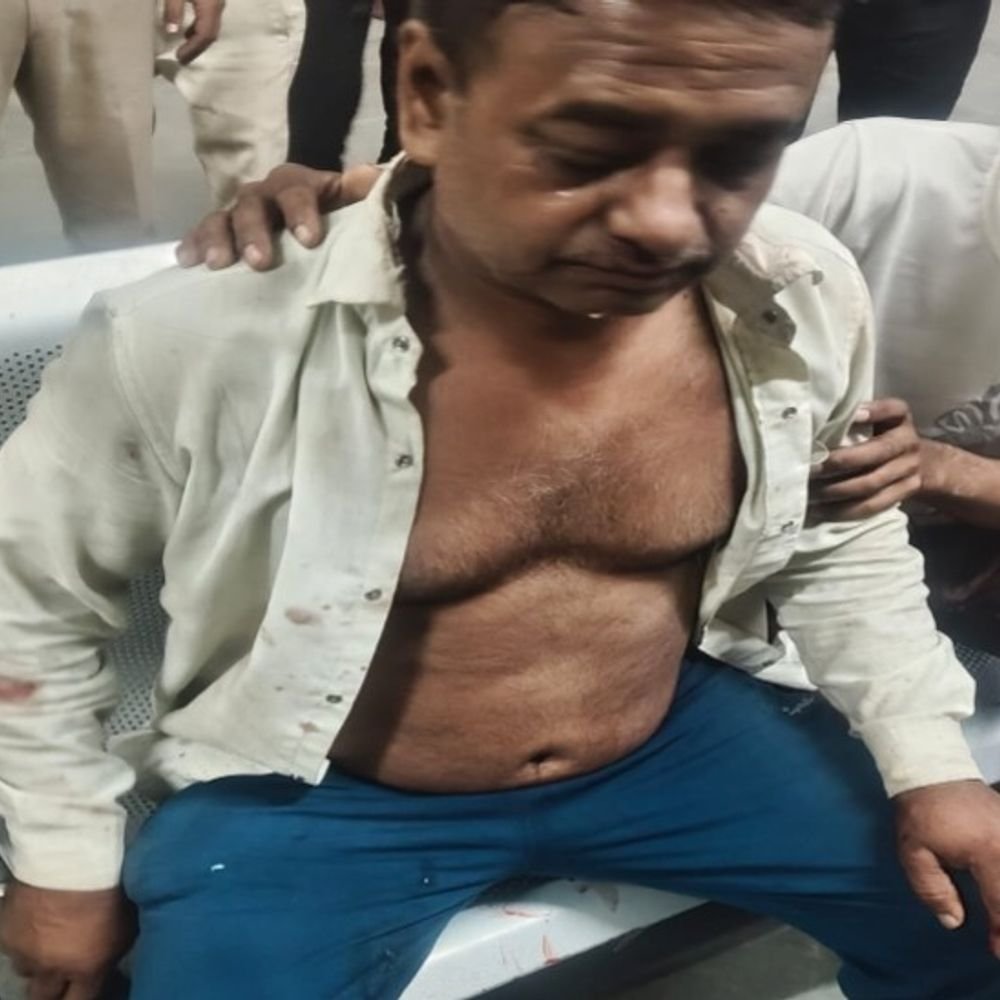 शाहजहांपुर में खंभे पर केबल बांधने को लेकर विवाद, फायरिंग:दोनों पक्षों के 11 लोग घायल, कई को लगे छर्रे