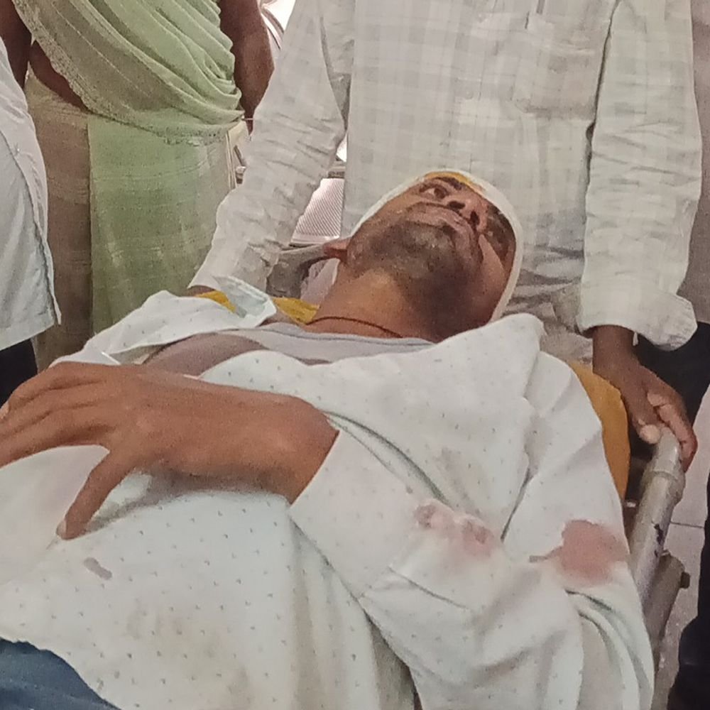 रुदलापुर के पास सड़क हादसे में युवक गंभीर घायल:सिद्धार्थनगर के बहादुरपुर निवासी हैं, महराजगंज जिला अस्पताल में इलाज जारी