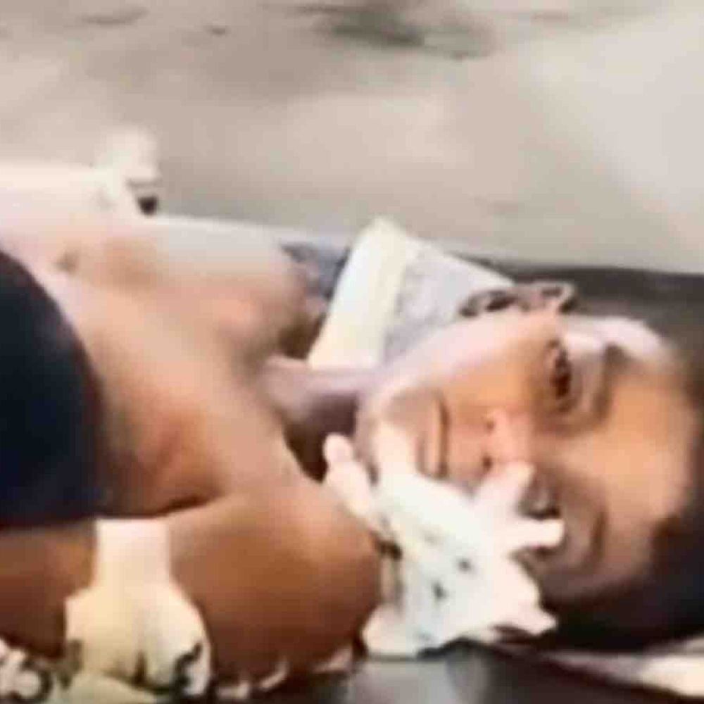 रामपुर में आवारा कुत्तों का हमला:जंगल से घर लौट रहे 7 साल के मासूम को 10 जगह काटा; गंभीर हालत में जिला अस्पताल रेफर