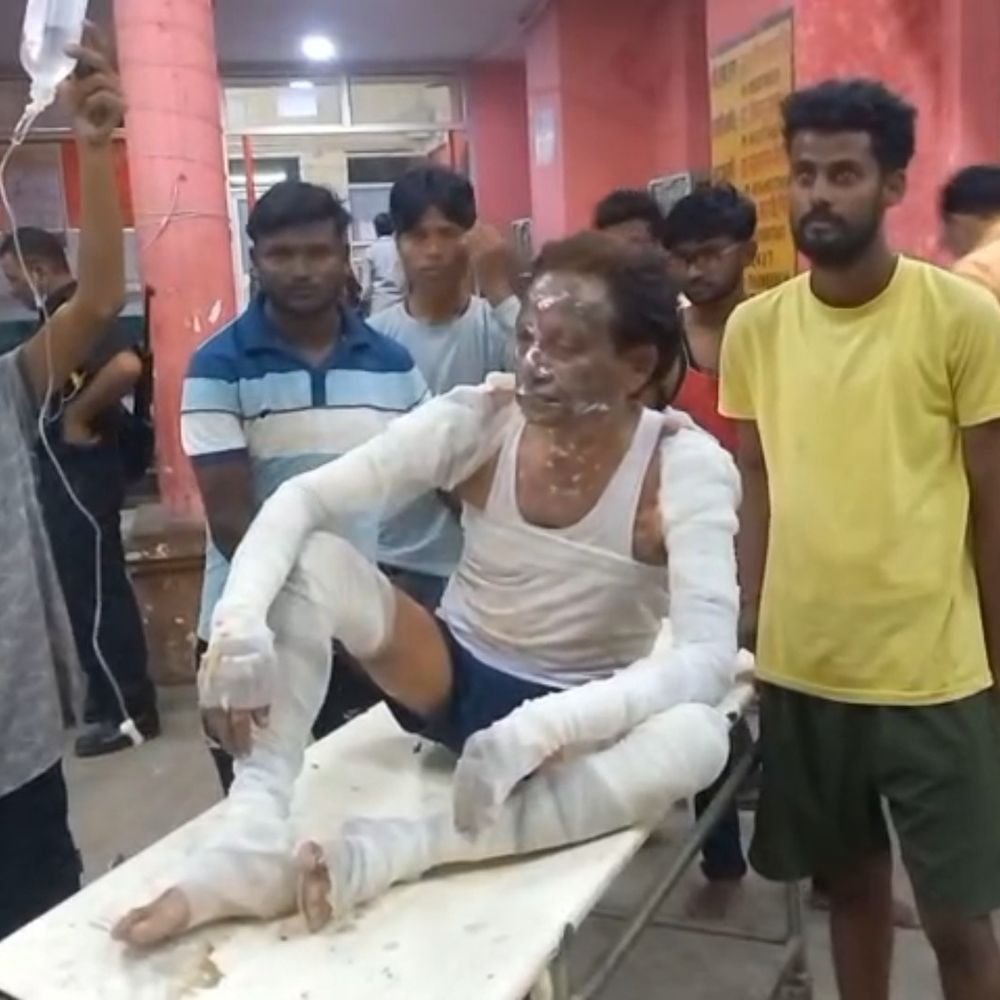 गैस पर खाना बनाते समय आग से झुलसा युवक:फिरोजाबाद में गंभीर हालत देख डॉक्टरों ने आगरा रेफर किया, पत्नी गई थी बाहर