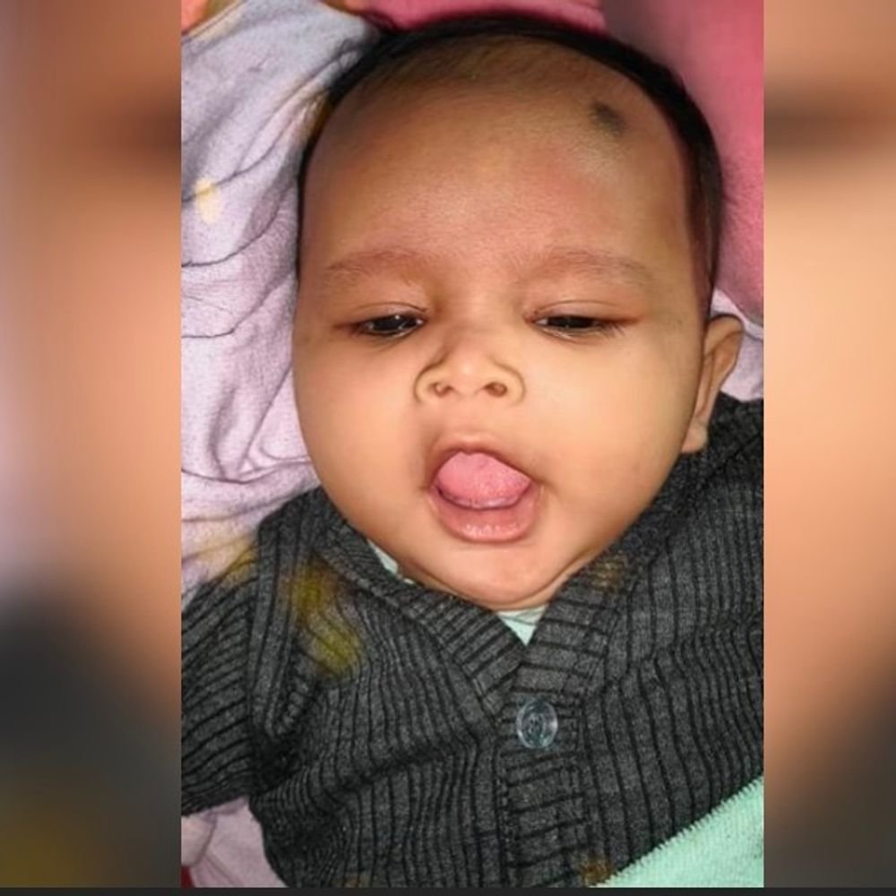 कौशांबी में सोफे पर सो रही मासूम की जलकर मौत:चाने में चाचा भी झुलसे, कमरे में लगी आग से जला सामान, शॉर्ट सर्किट की आशंका