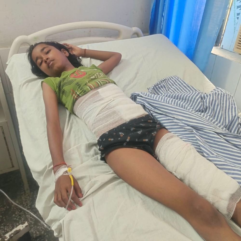 सड़क हादसे में परिवार के 10 लोग घायल:खीर लेकर मंदिर जा रहे परिवार का पलटा था ई-रिक्शा, पांच बच्चों समेत 10 घायल