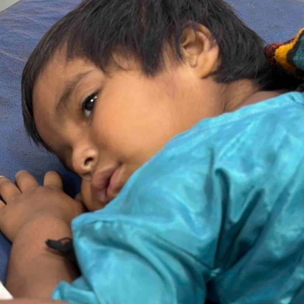 रामपुर में कुत्तों के झुंड ने बच्ची पर किया हमला:दो बच्चों को बनाया निशाना, ग्रामीणों ने की कार्रवाई की मांग