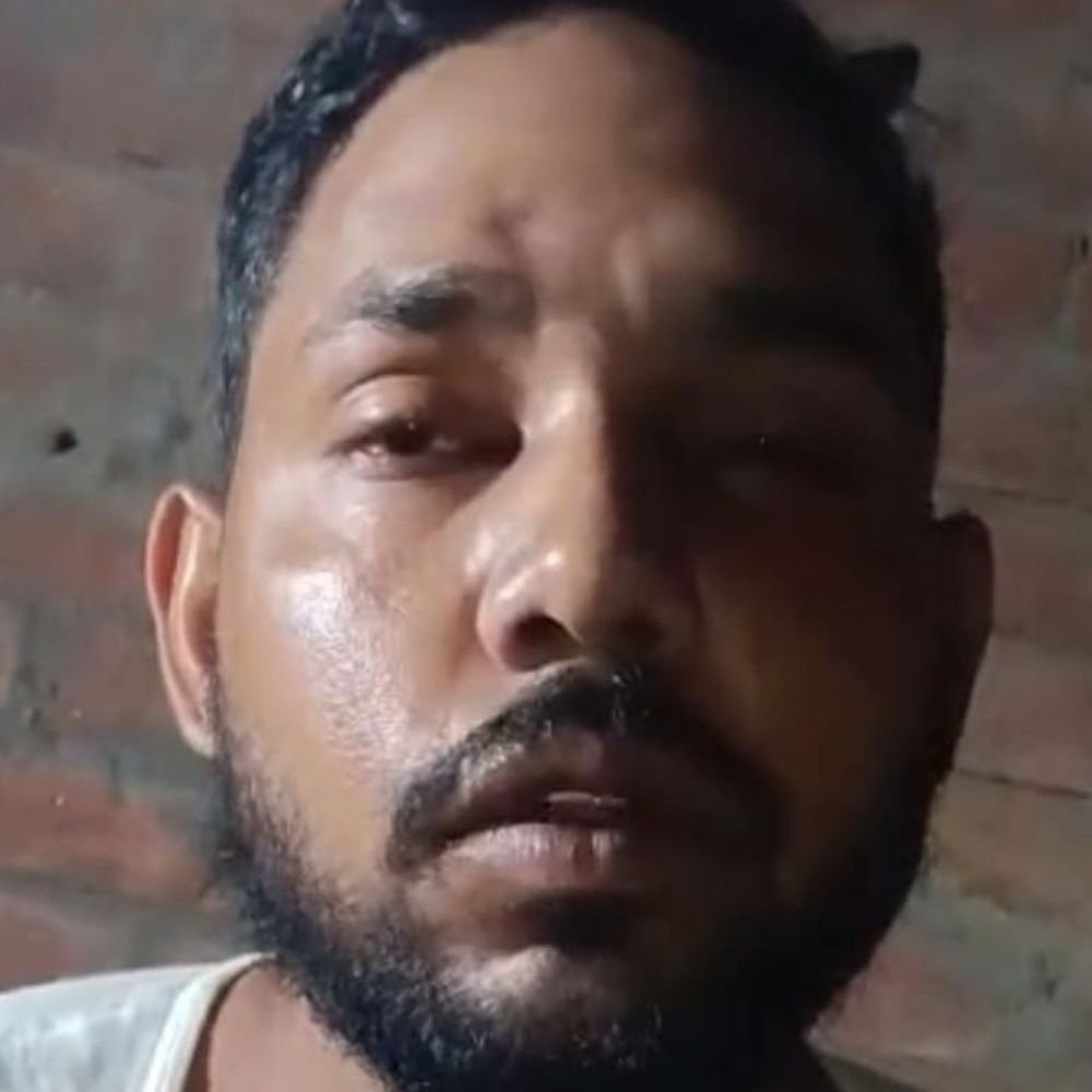 मेरठ में पत्नी ने काटा पति का प्राइवेट पार्ट:शादी के 7 सालों में भी नहीं हुआ था बच्चा, पति करता था किरदार पर शक, नशीली कॉफी पिलाकर किया हमला