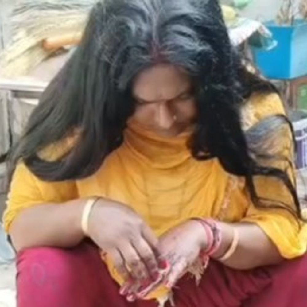 मथुरा में किन्नर पर ड्राइवर ने चाकू से किया हमला:तीन लाख रुपये के लेनदेन को लेकर विवाद, आरोपी पर केस दर्ज