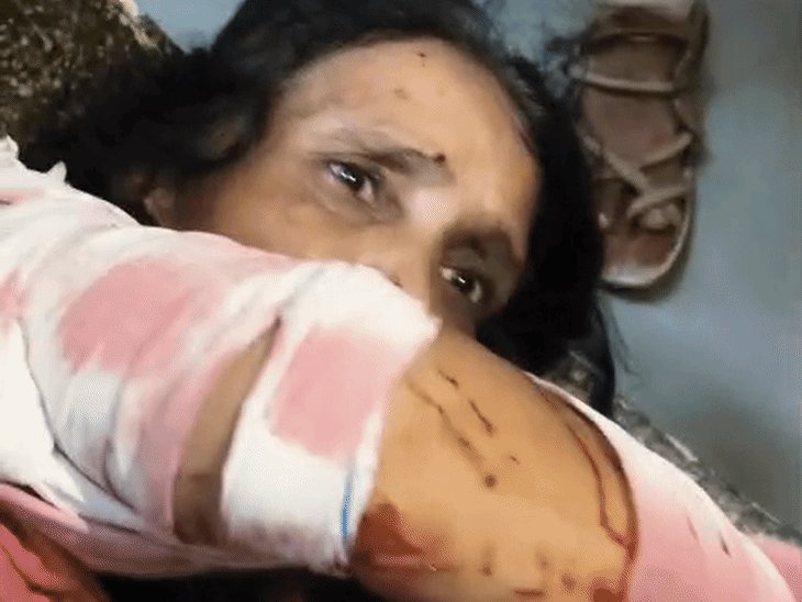 प्रतापगढ़ के पट्टी में दंपती पर चाकू से हमला:दोनों लहूलुहान होकर जमीन पर गिरे, मौके से हमलावर फरार; तलाश में जुटी पुलिस