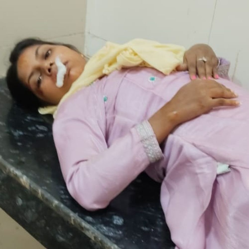 सोहगौरा में कुत्ते को बचाने में अनियंत्रित होकर गिरी बाइक:पिता-पुत्री गंभीर रूप से घायल, जिला अस्पताल में भर्ती